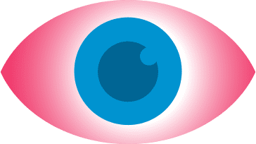 Contact lens-induced acute red eye (CLARE) eye icon. Blue eye, very red and irritated